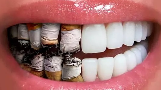 vape and teeth Cigarette électronique et toux : comment en finir ? main image 1