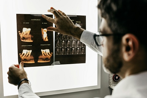 dental jargon